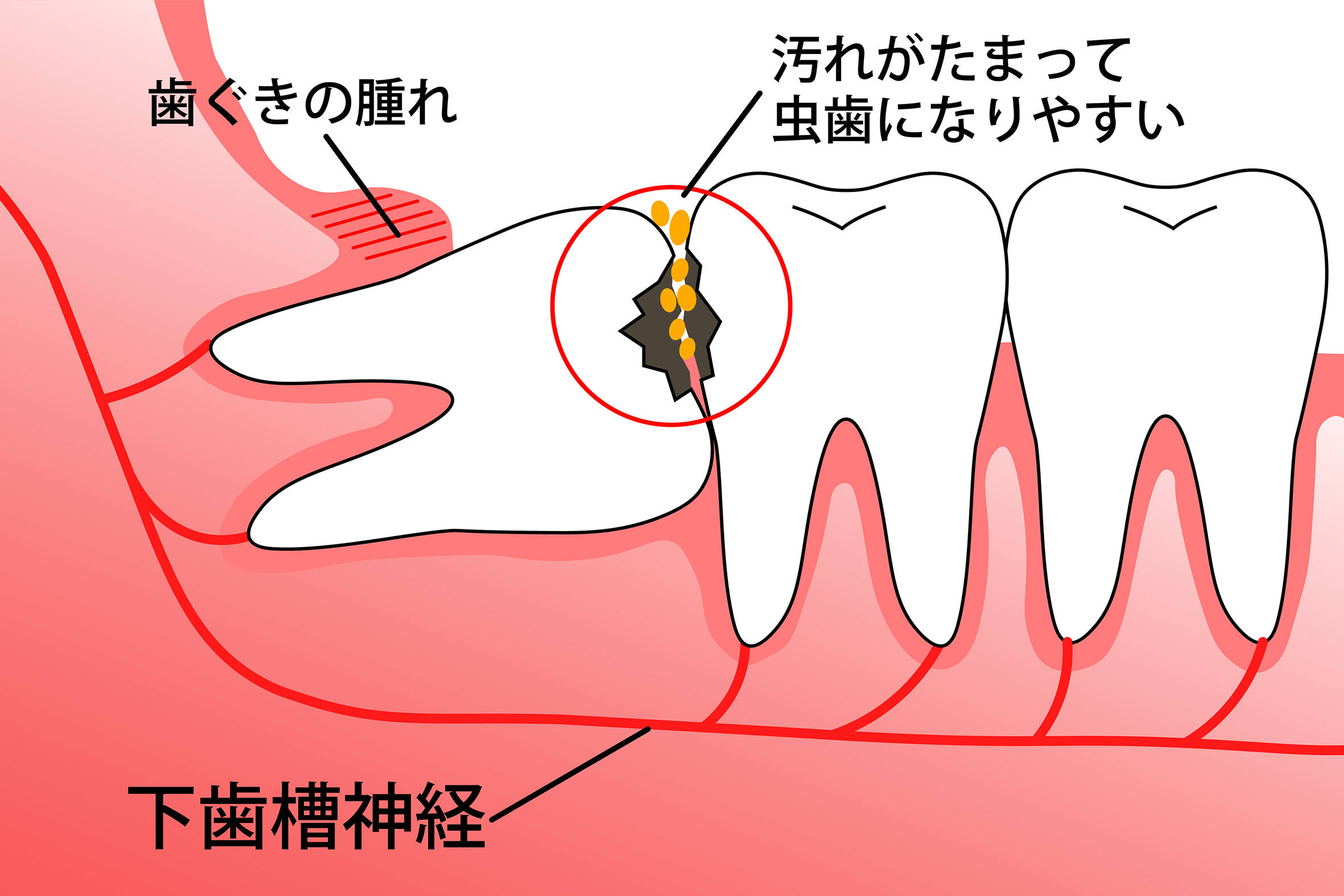 埋伏智歯（まいふくちし）とは